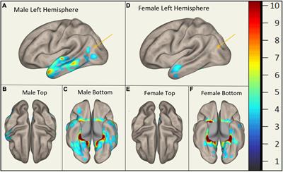 Sex differences in brain functional connectivity of hippocampus in mild cognitive impairment